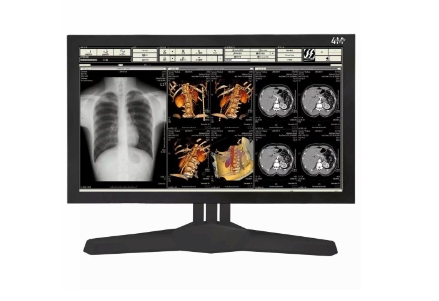 醫(yī)療顯示器的重要性(醫(yī)療顯示器技術(shù)特點(diǎn))