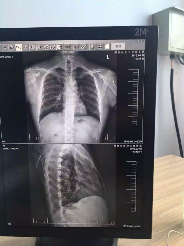 27寸醫(yī)療顯示器—大屏幕中的精確診斷與視覺革新